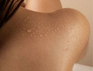 dermatologija