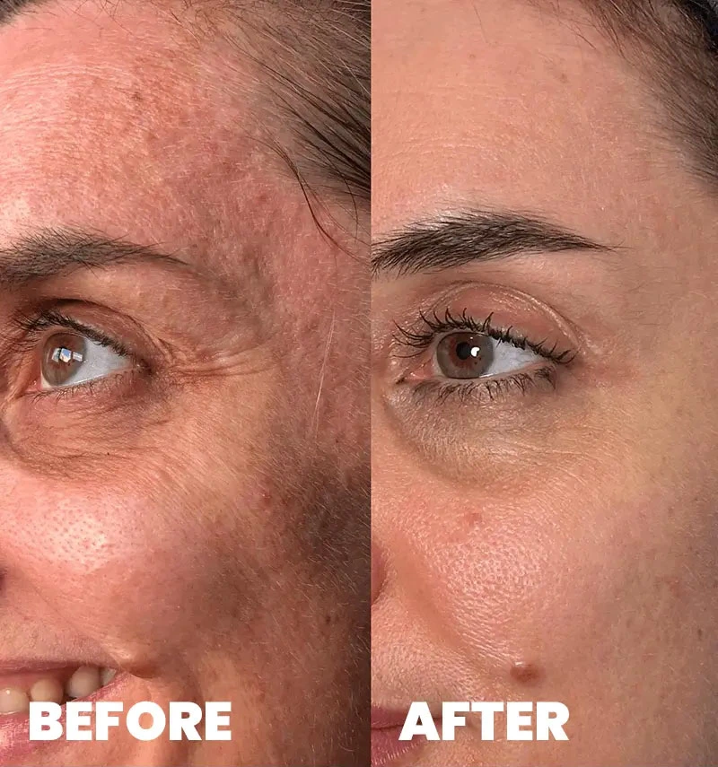 before-after-section-1-7-MJ dr. med. Marija Jaramaz