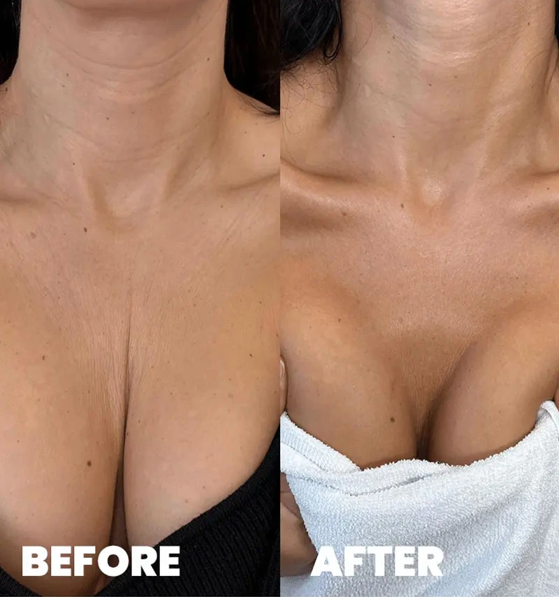 before-after-section-1-9-MJ dr. med. Marija Jaramaz