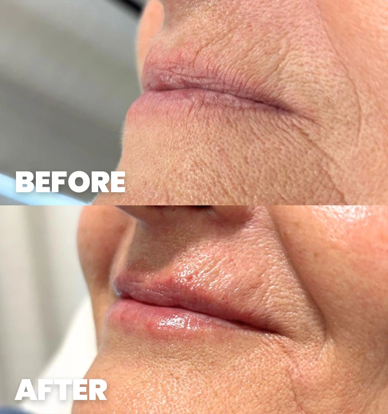 before-after-section-2-1-DB dr. med. Dora Barić