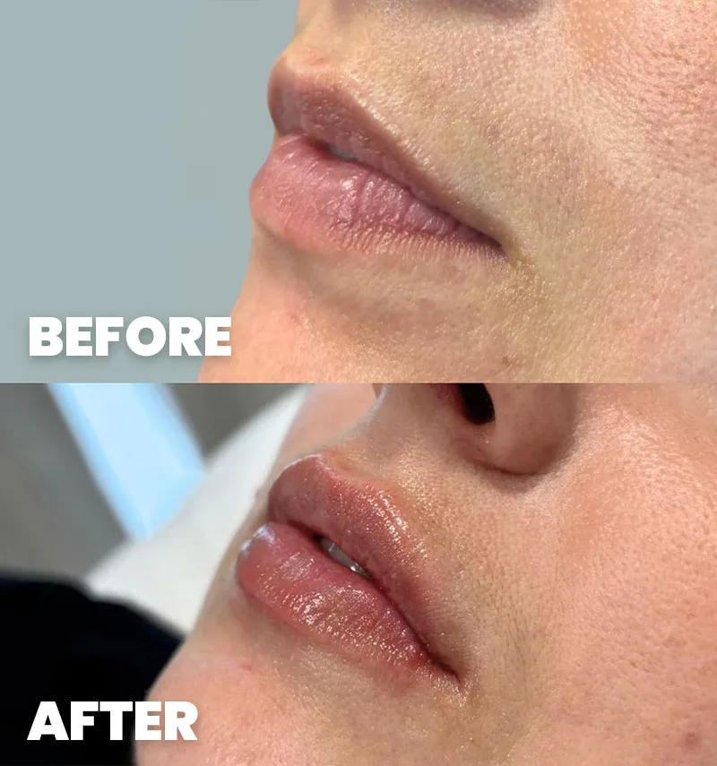 before-after-section-2-2-DB dr. med. Dora Barić