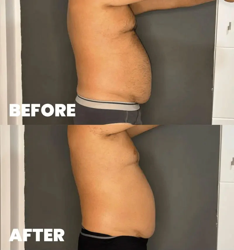 before-after-section-3-1 Before After Work