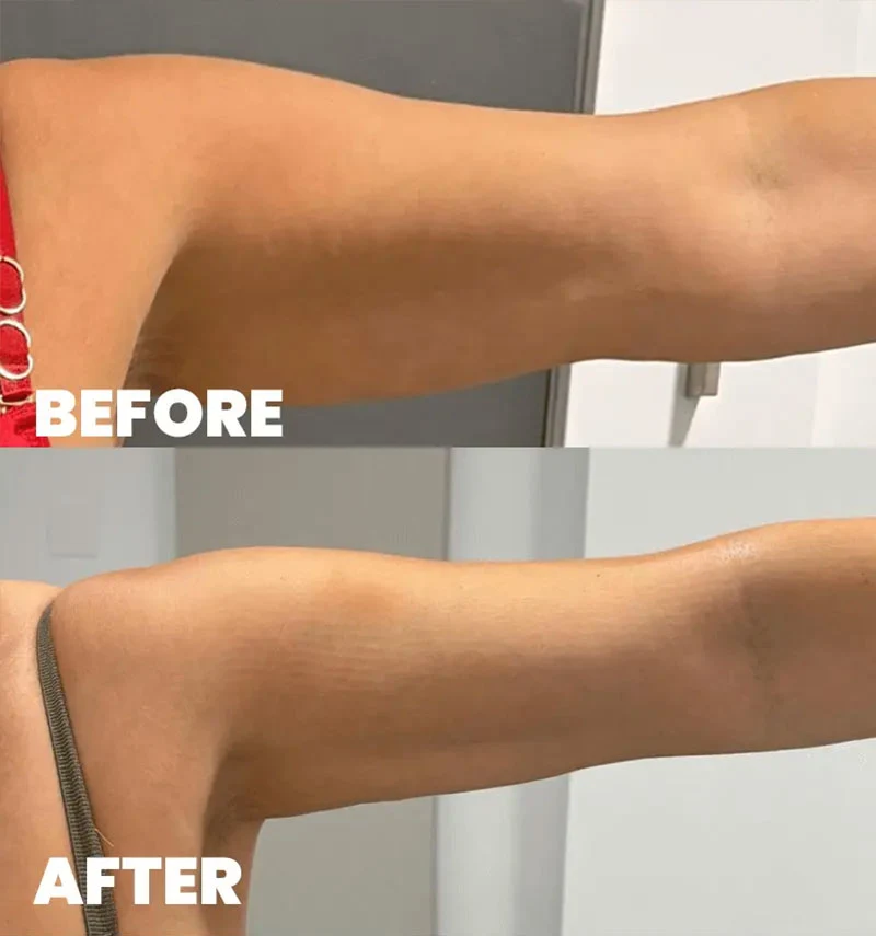 before-after-section-3-2 Before After Work